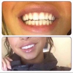 Whitening fluoride toothpaste