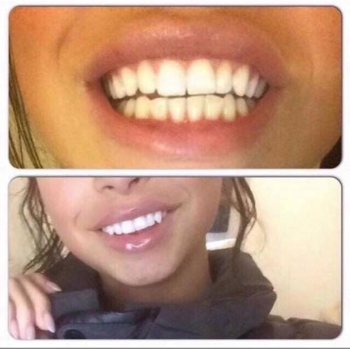 Whitening fluoride toothpaste