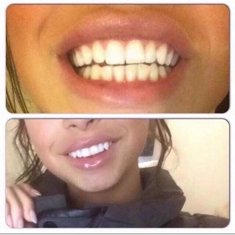 Whitening fluoride toothpaste