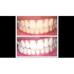 Whitening fluoride toothpaste