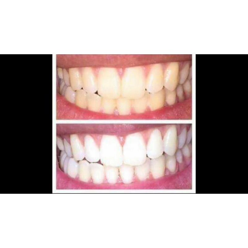 Whitening fluoride toothpaste