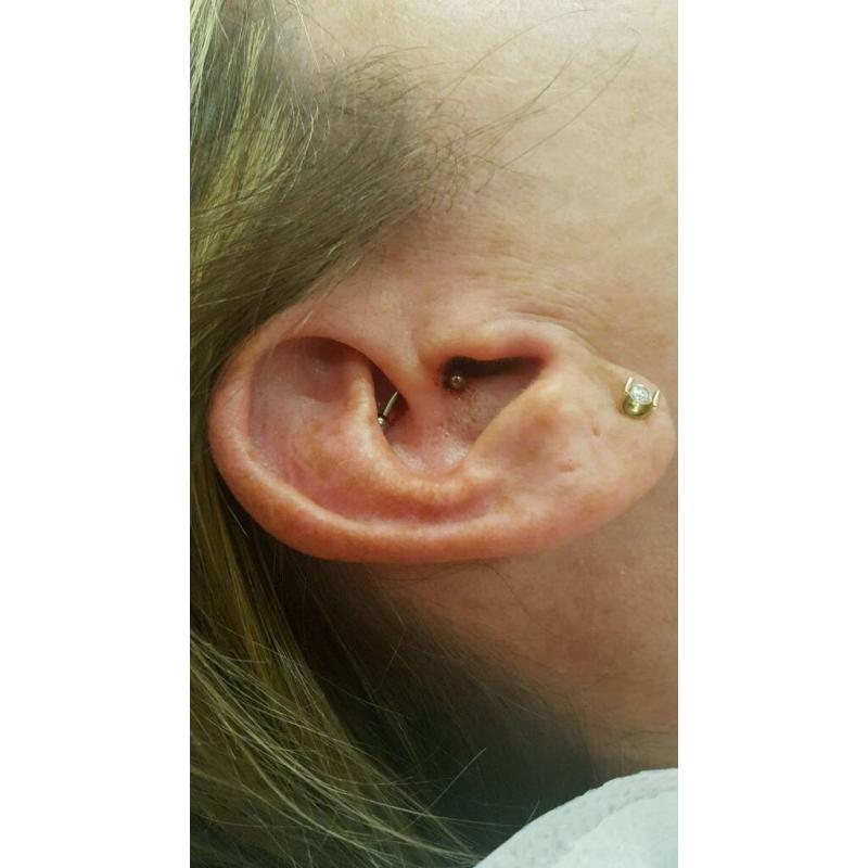 Body piercing
